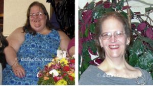 elizabeth before and after